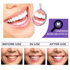 Get Brighter Smile with Whitening Toothpaste