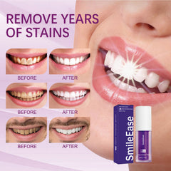 Brighten Your Smile with Whitening Toothpaste for Radiant Teeth